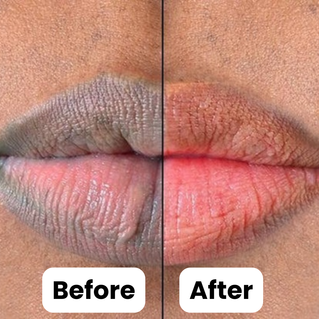 BrightLips